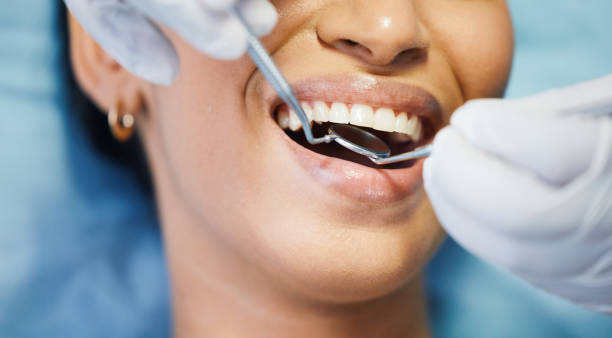 Best Urgent Tooth Repair  in Ellijay, GA