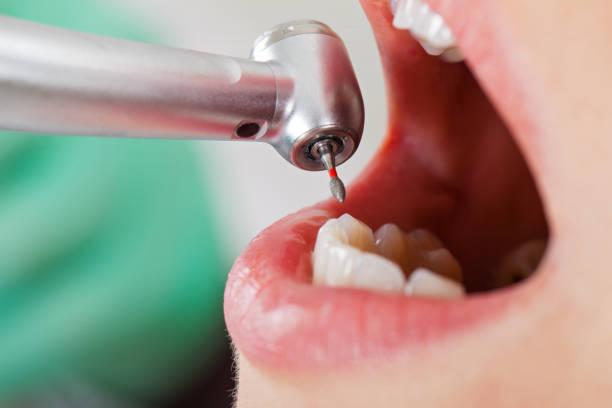 Best Tooth Infection Emergency Dentist  in Ellijay, GA